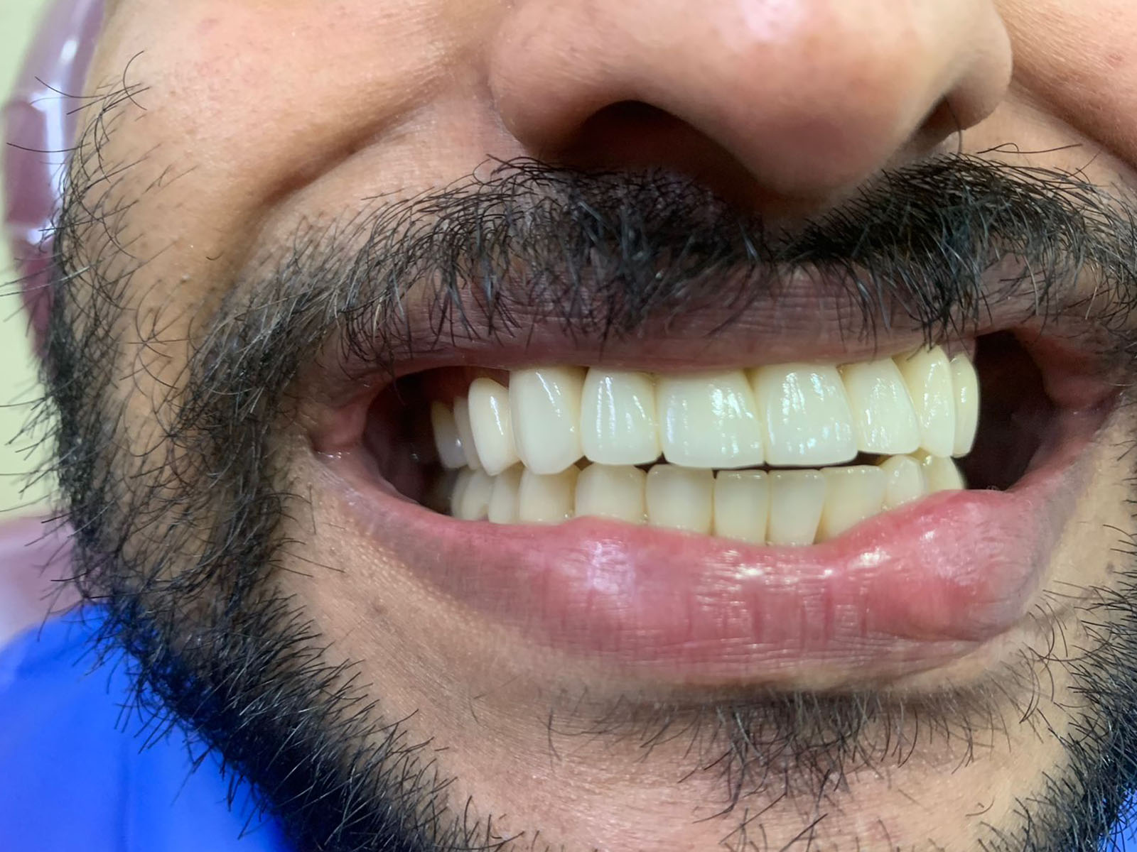 https://shifadentalclinic.in/wp-content/uploads/2022/08/after.jpg