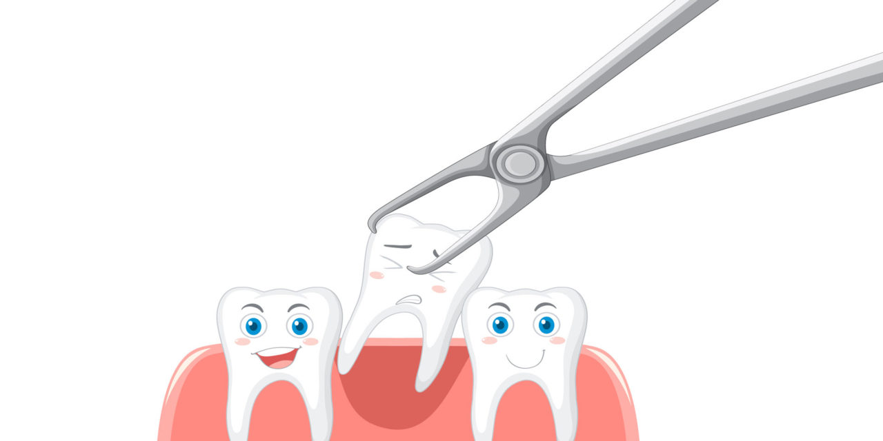 Care After Tooth Extraction