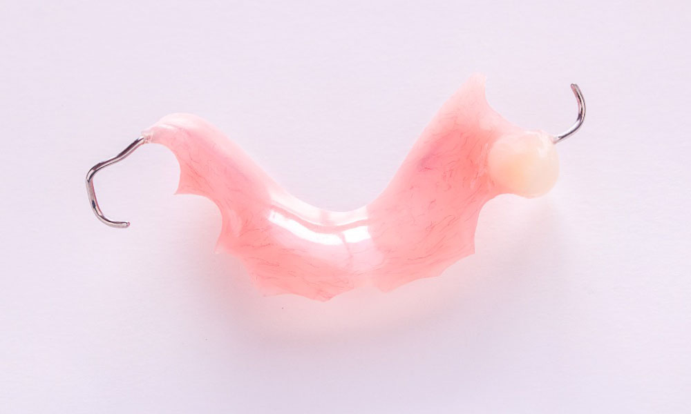 REMOVABLE PARTIAL DENTURE-prosthodontics